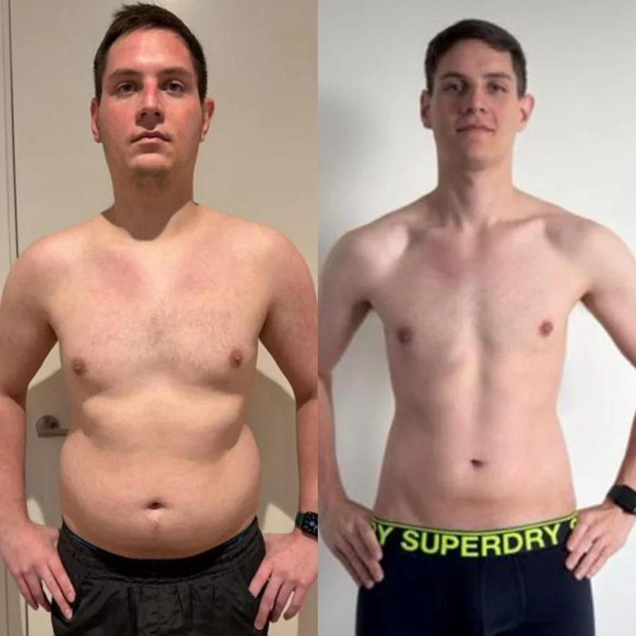 Emile before and after transformation