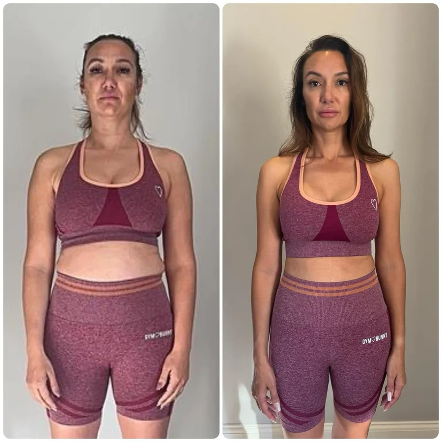 Alana transformation